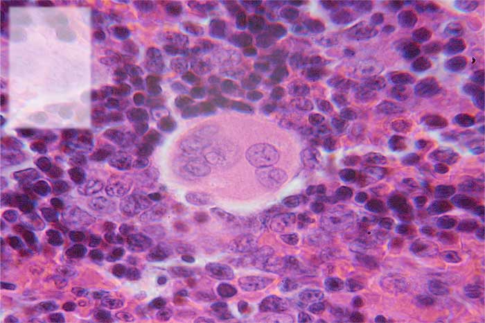 tissue types
